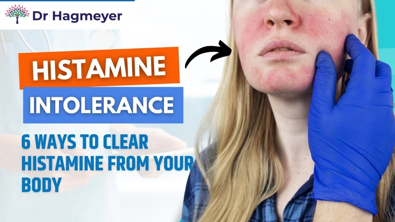 How to Clear Histamine- How To Get Rid of Histamine in 6 Easy Steps💪 Dr. Richard Hagmeyer