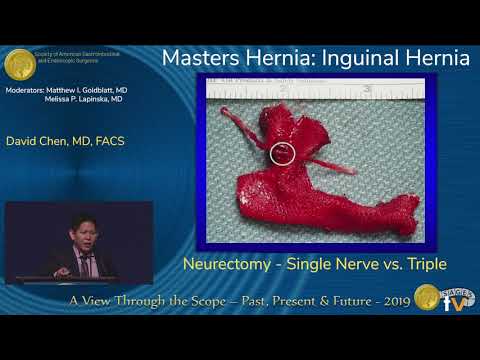 Neurectomy - Single Nerve vs. Triple Neurectomy