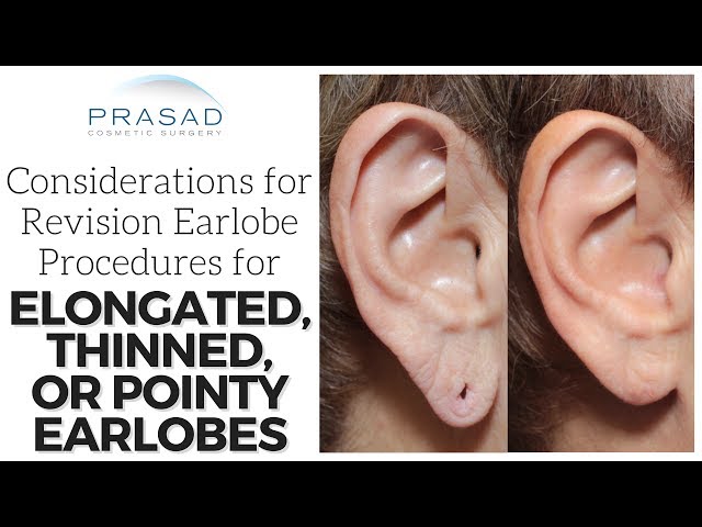 Video Pronunciation of earlobe in English