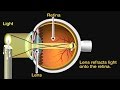 How The Eye Works Animation How Do We See Video Nearsighted Farsighted Human Eye Anatomy