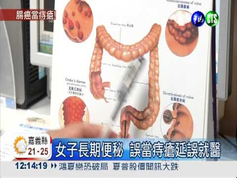 女子便秘當痔瘡 罹大腸癌渾不知