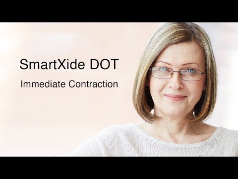 Deka Dot Immediate Contraction