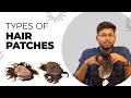 Hair Patches Choosing The Right Type For You Berkowits