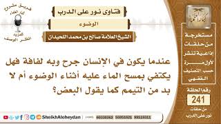 عندما يكون في الإنسان جرح وبه لفافة فهل يكتفي بمسح الماء عليه أثناء الوضوء أم لا بد من التيمم؟ image