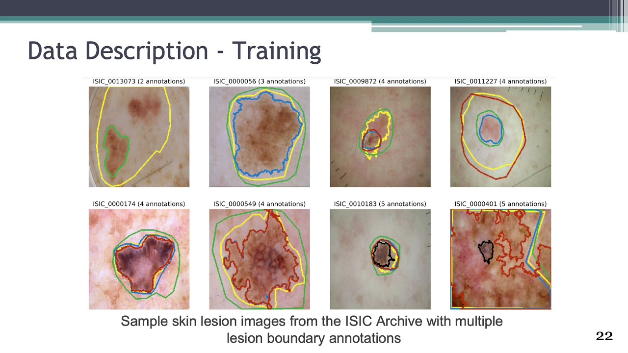 D-LEMA: Deep Learning Ensembles from Multiple Annotations (Full)