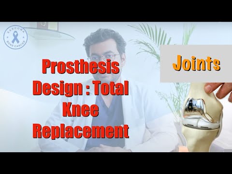Optimal Prosthesis Design for Total Knee Replacement: Best Results Explained by Dr. Deepak Garg