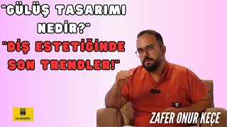 Gülüş Tasarımı Nedir? Hollywood Smile ve Diş Estetiği Hakkında Her Şey