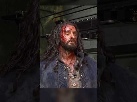 This PAINFUL mishap happened during filming of the Hobbit!