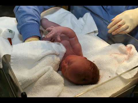 Fetal Monitoring Segment 3: Fetal Heart Rate