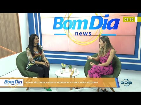 Dermatologista trata sobre micoses que se propagam e atacam a saúde do corpo 16 07 2021