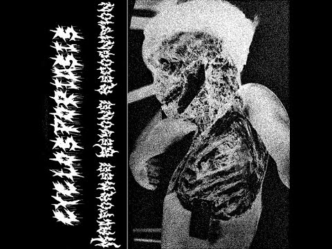 CYCLOSPORIASIS (Gorenoise / NY) / "Malformed Beyond Recognition" album preview