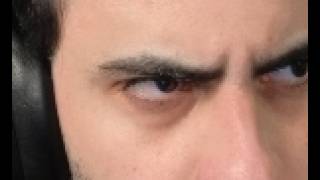 olhar do milto caído