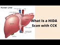 What Is A HIDA Scan With CCK