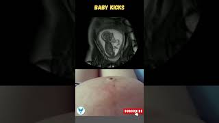 Baby kicks  Baby kicking inside belly  Baby milest