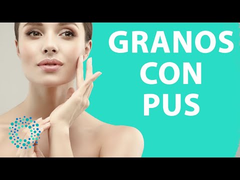 prostatite non vivo piu y