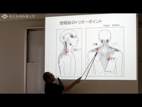 肩こりのトリガーポイント