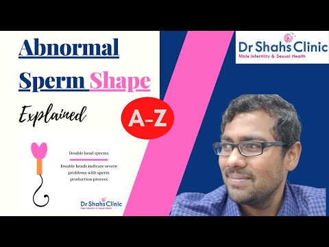 Abnormal sperm morphology and pregnancy & Teratozoospermia treatment explained