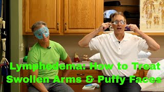 Lymphedema: How to Treat Swollen Arms & Puffy Faces.