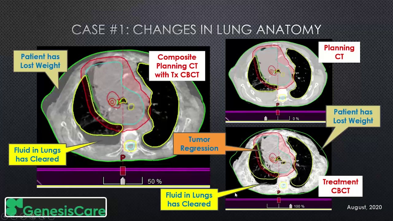 Adaptivo Case Studies