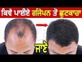 How to Get Rid of Baldness | Hair Transplantation | Hair Loss Treatment How to Get Rid of Baldness | Hair Transplantation | Hair Loss Treatment