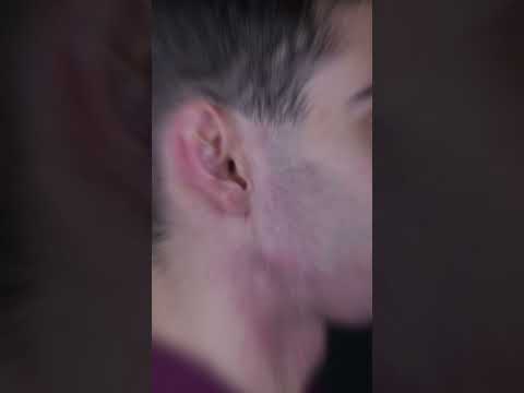 How double jaw surgery can change your airways and probably your life #airways #doublejaw