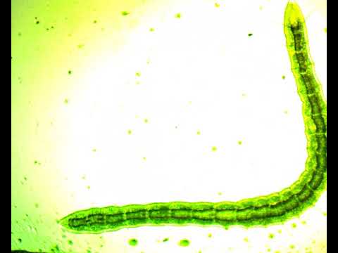 Detritus worm, part 1, 40x magnification