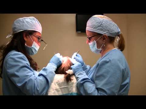 Transplantation de cheveux en vidéo