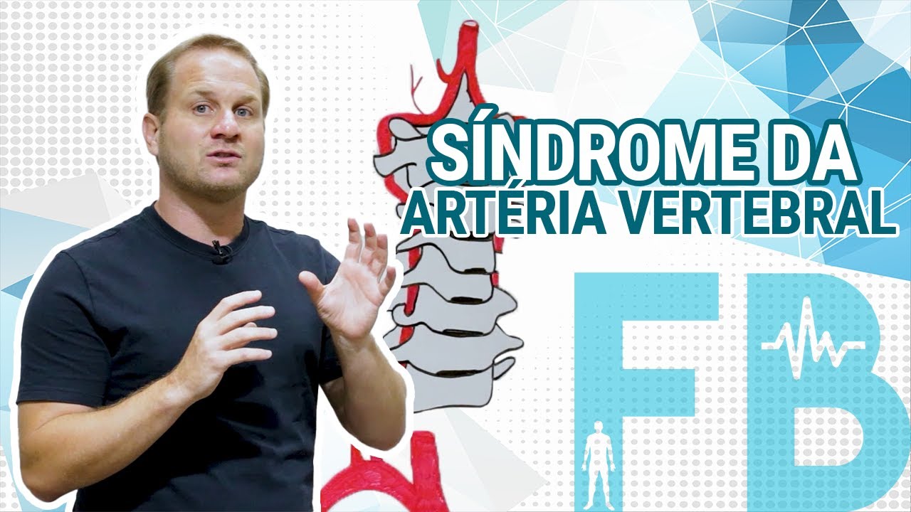 Síndrome da artéria vertebral