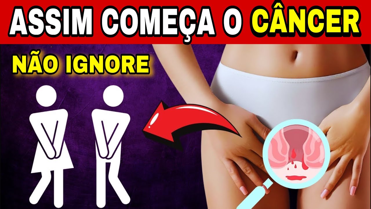 10 Sinais Comuns de CÂNCER! Veja Antes Que Seja Tarde