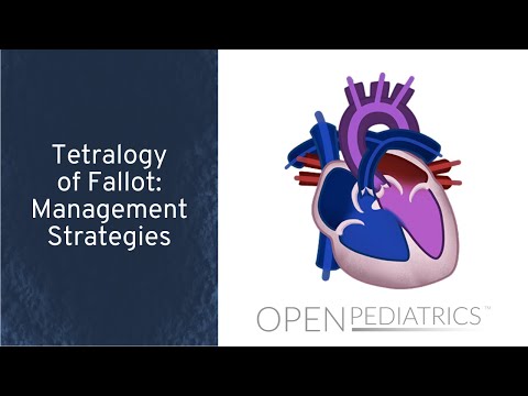 Tetralogy of Fallot: Management Strategies by P. Lang | OPENPediatrics