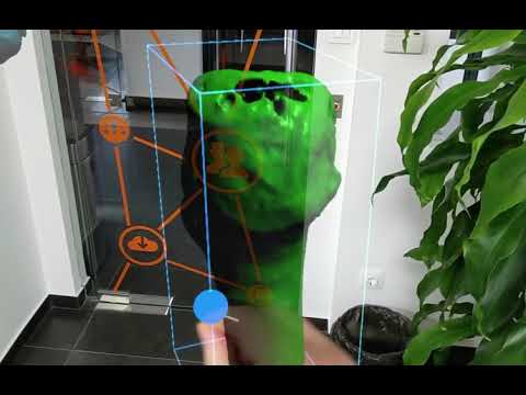 Augmented reality and navigation in reconstructive orthopaedic surgery.