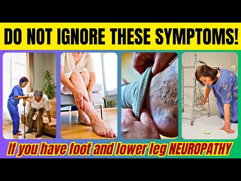 5 WARNING SIGNS for Lower Leg and Foot Tingling, Numbness, Pins & Needles Sensation| Doc Cherry