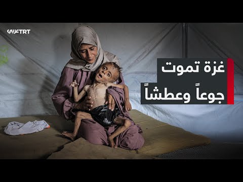 غزة تحتضر جوعاً