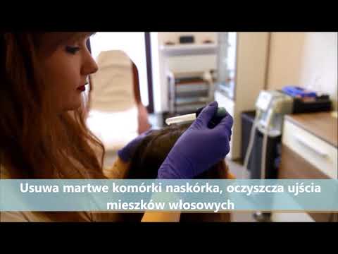 Najlepsze do stylizacji włosów Wella Łysienie plackowate wideo