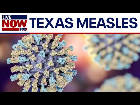 Video | BREAKING: First measles death reported in Texas