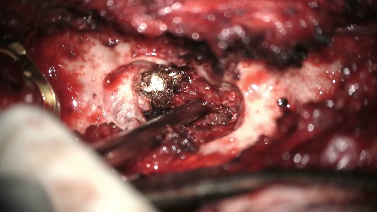 Jose Vicente Vasconez Fabre-21