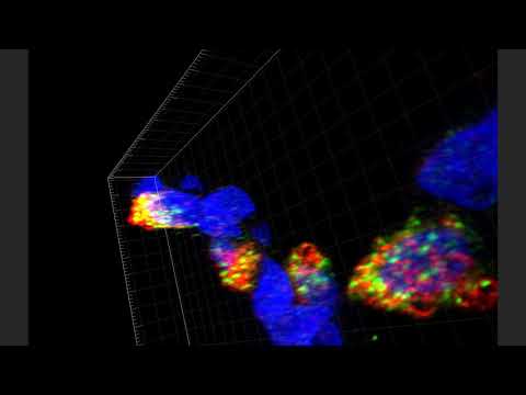 4 Month-Old Human Lung Donor D075 4 Month-Old Human Lung Donor D075