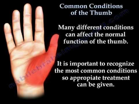 image-Are there joints in your palm?