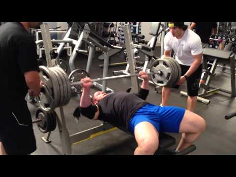 Rompimento e Desinserção do Peitoral Maior (175KG)