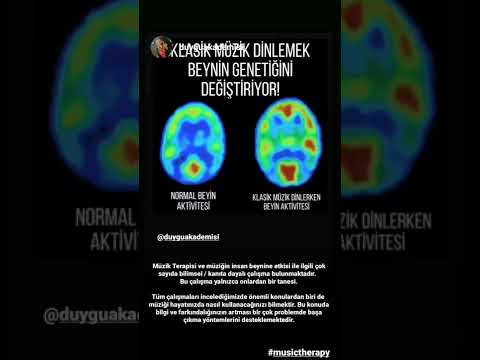 Klasik Müzik Dinlemenin Beyin Üzerindeki Etkisi