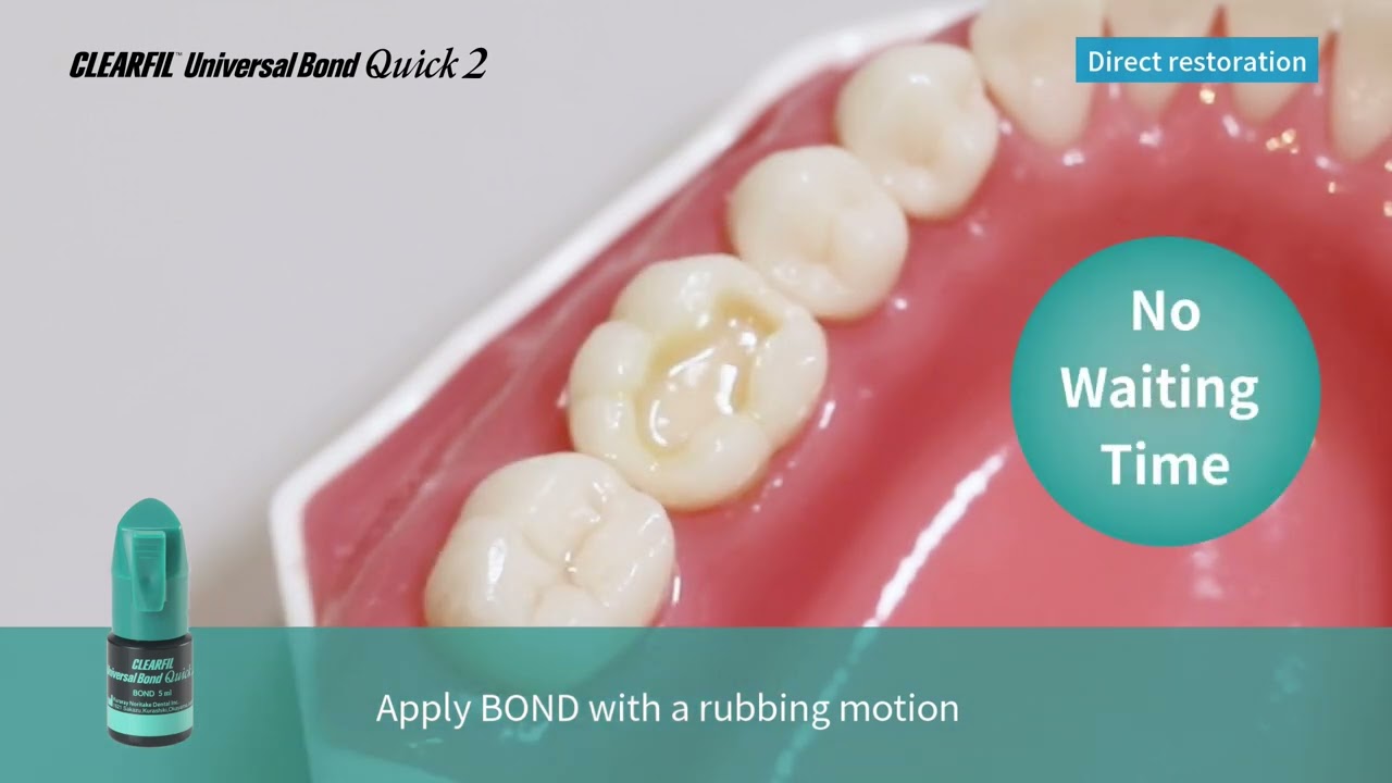 1. Direct Restoration with Packable Composite