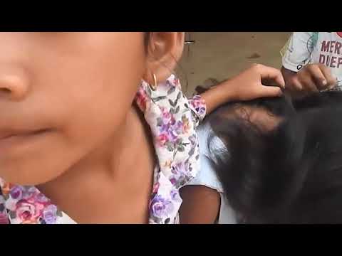 Remove many lice from brown hair - Plucking most of lice from head