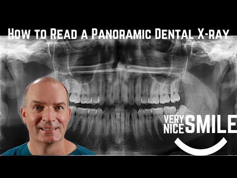 How to read a panoramic dental x ray