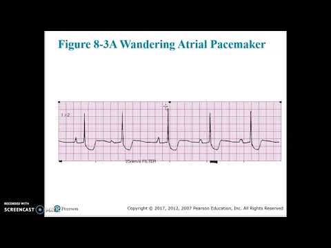 Cardiac Chapter 8 Video 2