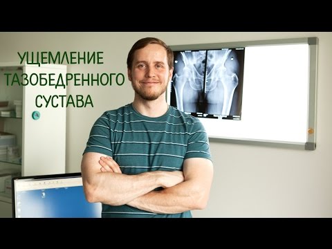Лекарства от суставов цена Заболевания позвоночника симптомы лечение