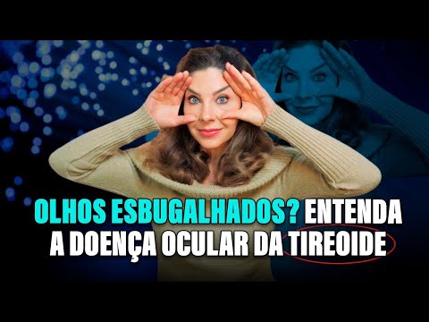 Bulging Eyes - Understanding Thyroid Eye Disease (TOD)