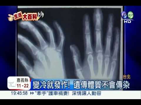 天氣變冷就發癢 乾癬病患激增!