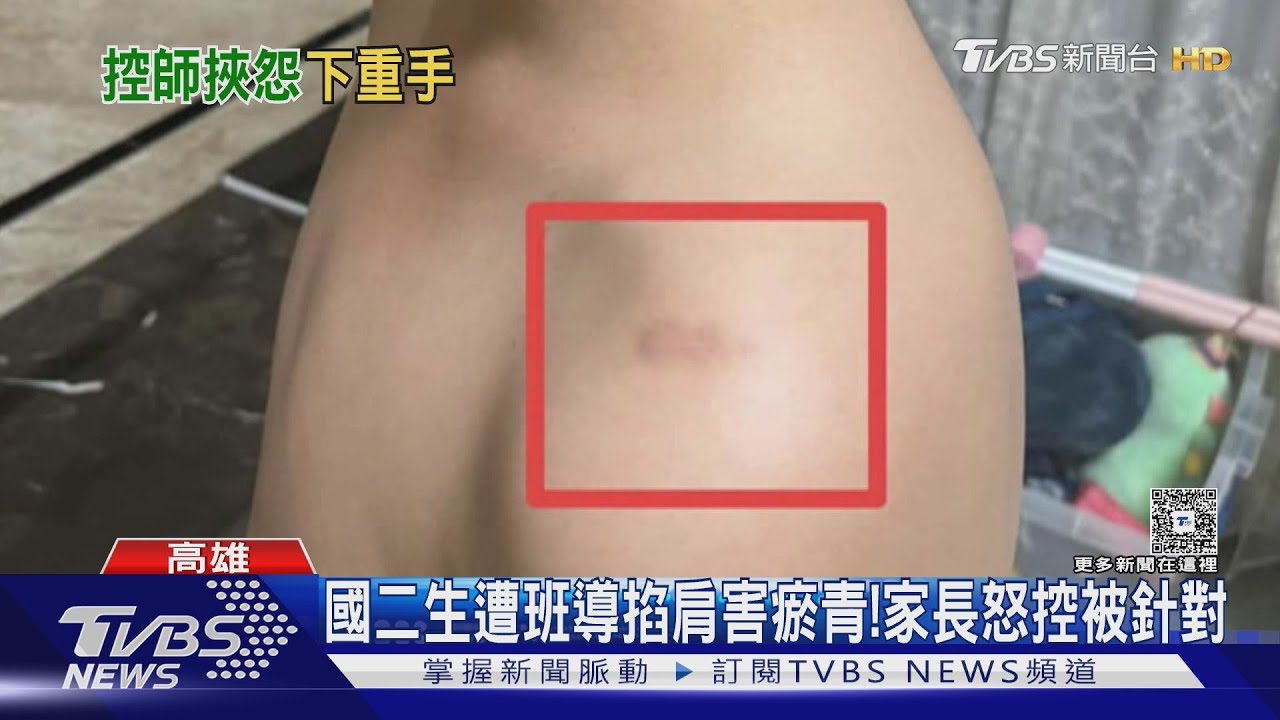國二生遭班導掐肩害瘀青! 家長怒控被針對