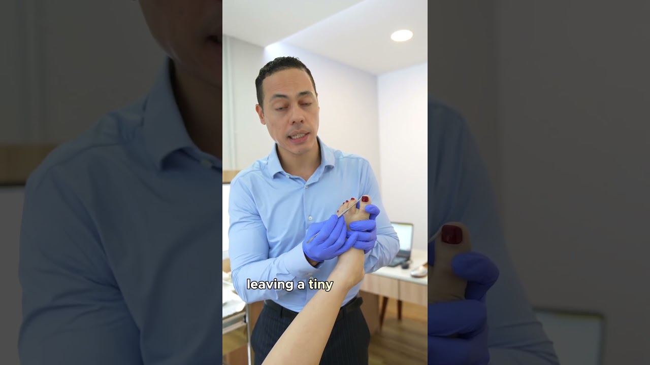 Avoid this error when cutting your toenails. #feet #footandankle #familypodiatry #nails