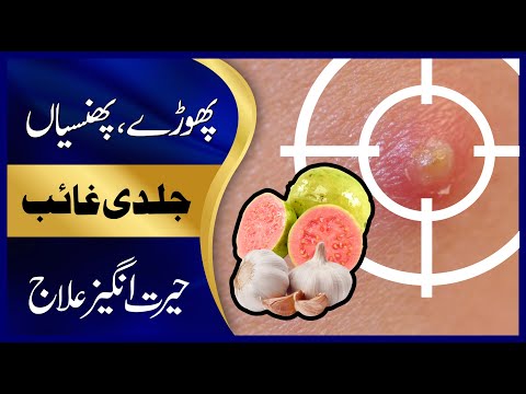 Phunsi ka ilaj in urdu | Peep wale dano ka ilaj